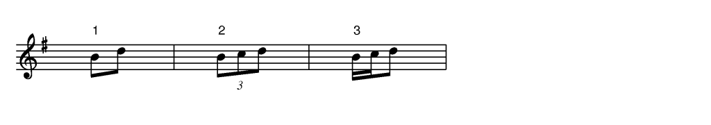 L'ornementation en musique irlandaise 54 Le Triplet - Ornementation dans la musique traditionnelle irlandaise